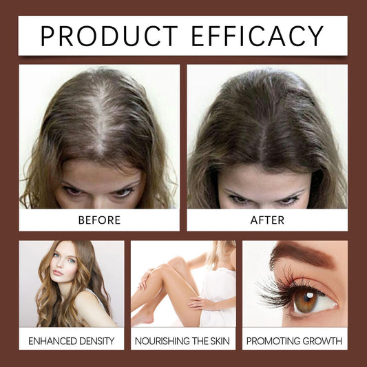 Xiyue All-in-one Castor Oil Is An Essential Oil For Multi-effect Care, Moisturizing Skin, Eyelashes And Eyebrows